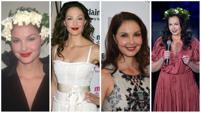 Ashley Judd's face accident Before and After