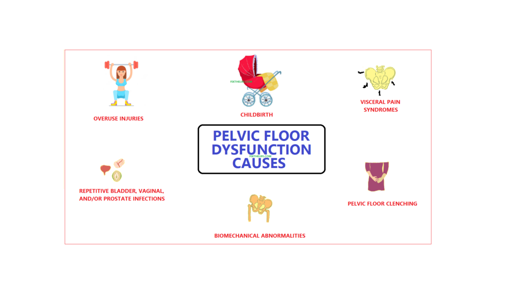 pelvic floor dysfunction causes