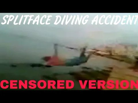 split face diving accident