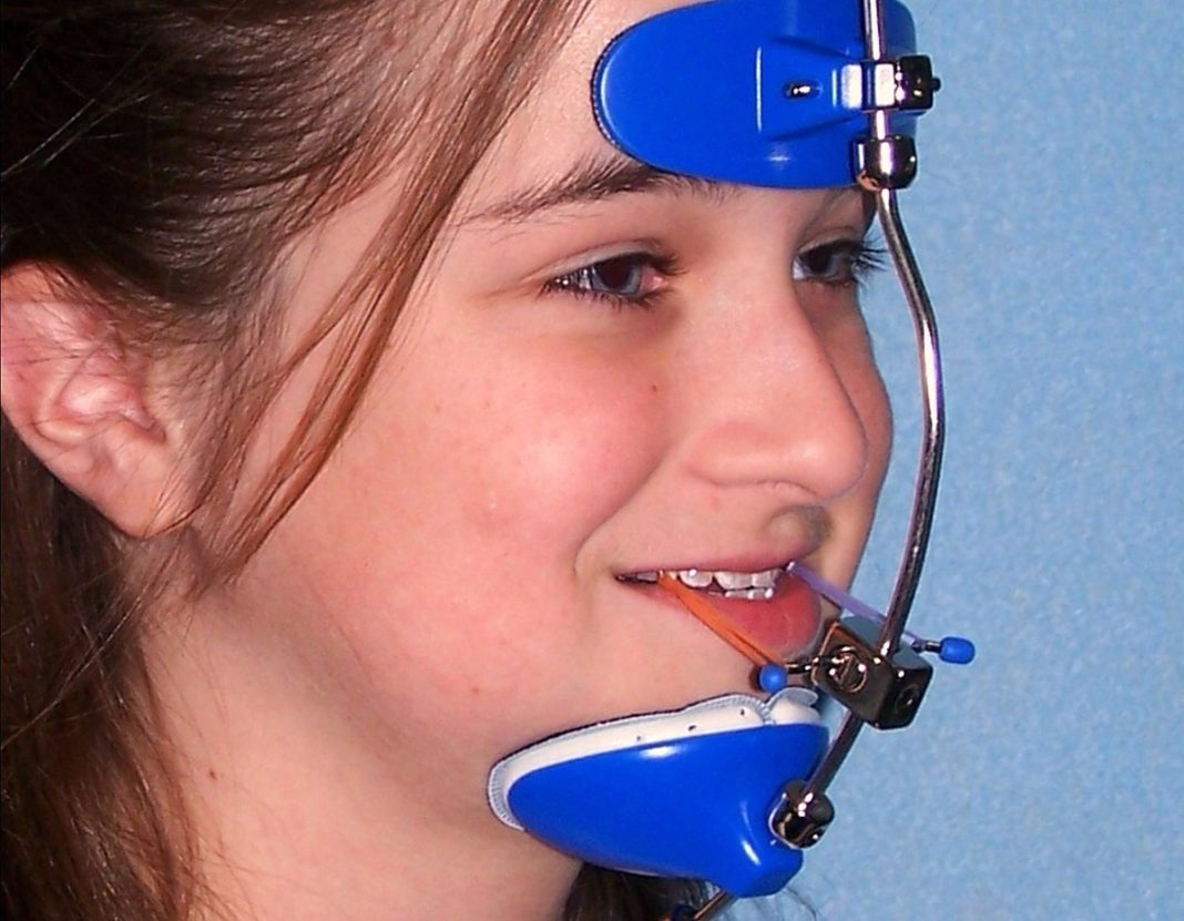 headgear-braces-different-types-of-orthodontic-headgear